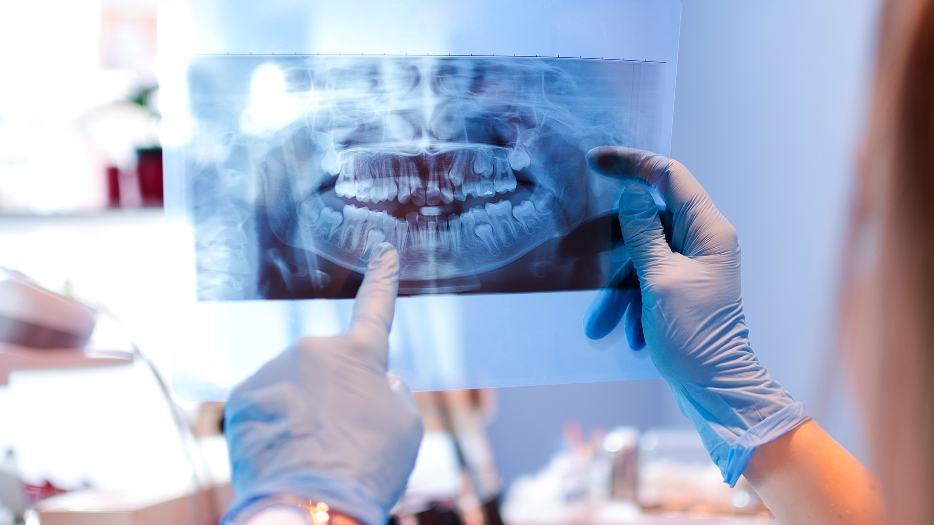 A dental professional examines an X-ray of a patient s mouth using a magnifying glass.