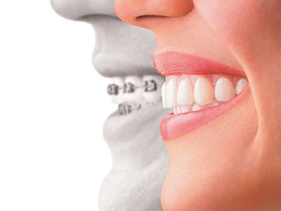 The image features a composite graphic with two halves of a smiling face placed side by side, each half showing teeth with dental implants, conveying the concept of improved oral health through dental implant technology.