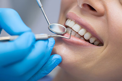 A woman receiving dental care with a dental tool being used on her teeth by a dental professional wearing blue gloves.