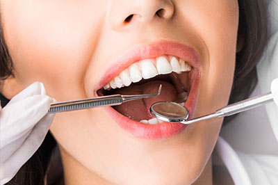A woman with a toothy smile has her mouth open wide while sitting in front of a dental professional, who appears to be examining her teeth using a mirror and a dental instrument.