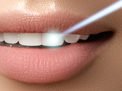 The image shows a close-up of a person s lips with a focus on a toothpaste product being demonstrated, featuring a blue light effect.